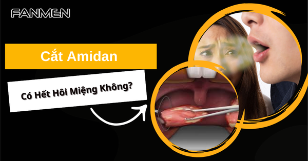 [Giải Đáp Chi Tiết] Cắt Amidan Có Hết Hôi Miệng Không?