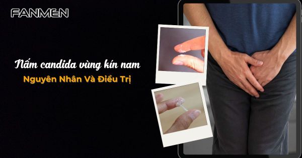Nấm Candida Vùng Kín Nam