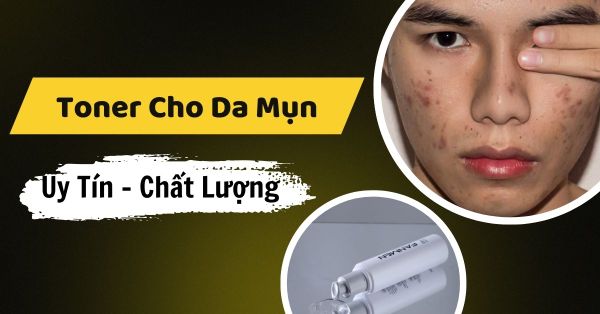 Thổi Bay Mụn Hiệu Quả Với 5 Toner Cho Da Mụn Hot Nhất 2026