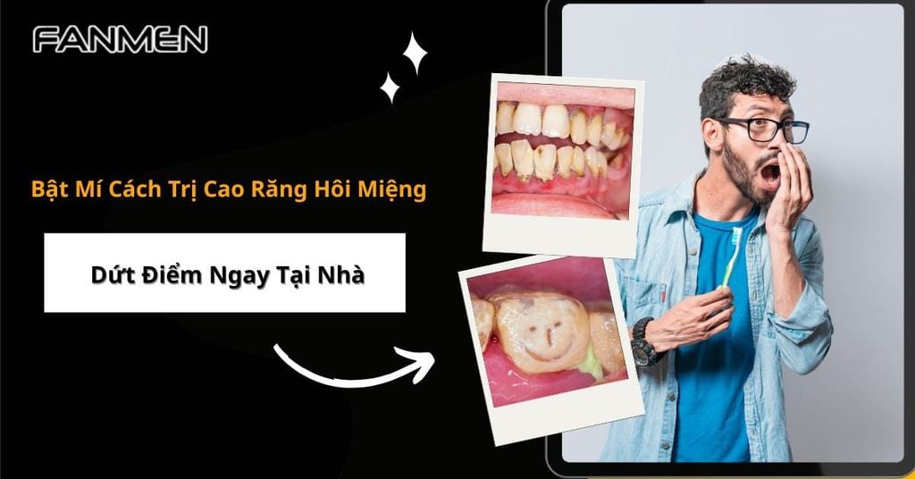 Cách trị cao răng hôi miệng