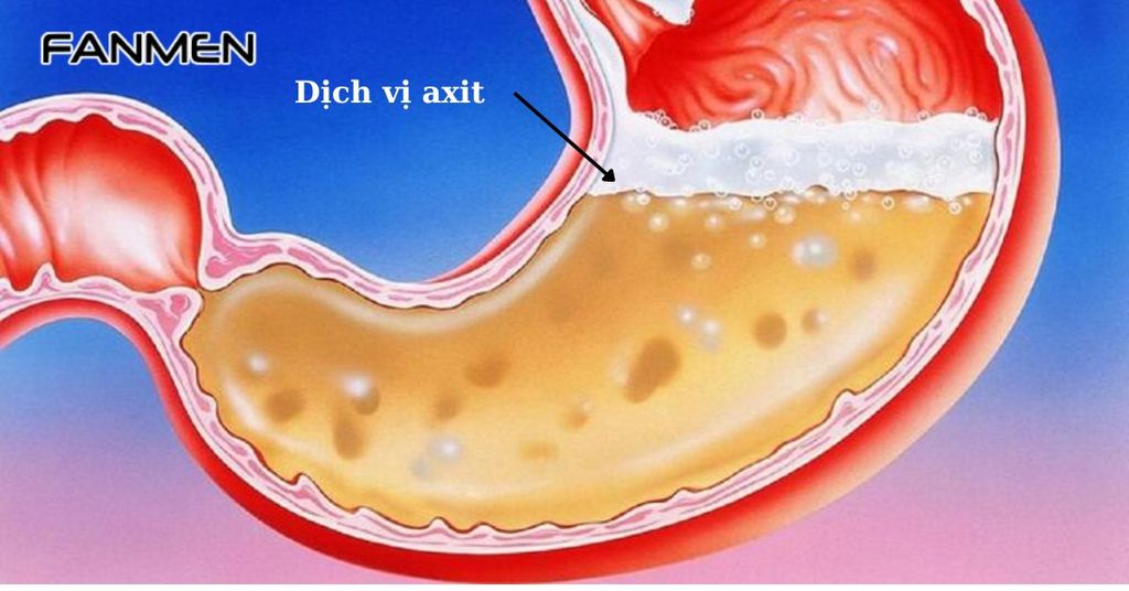 Dịch vị acid trào ngược lên miệng