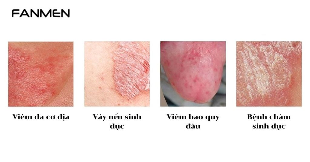 Do các bệnh lý