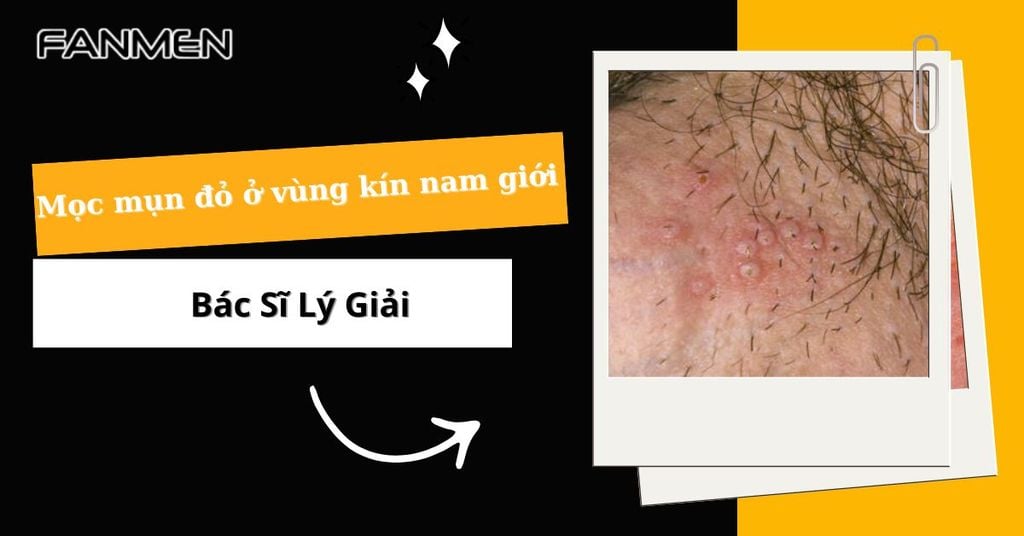 Mọc mụn đỏ ở vùng kín nam giới