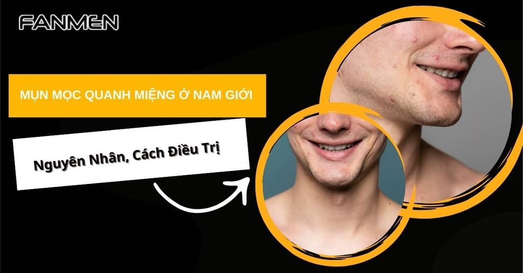 mụn mọc quanh miệng ở nam giới