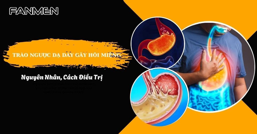 Trào ngược dạ dày gây hôi miệng