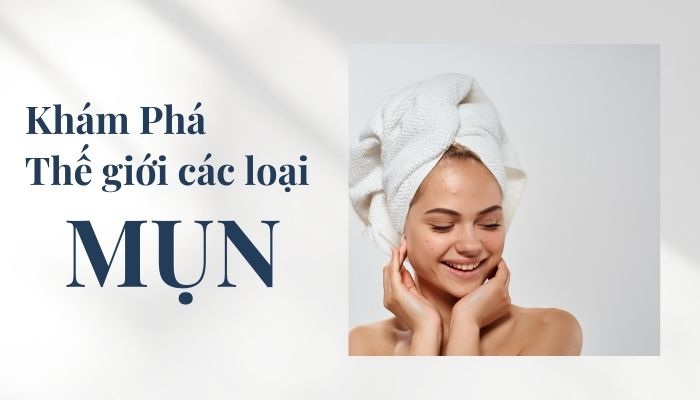 Khám phá thế giới của các loại mụn & cách chăm sóc hiệu quả