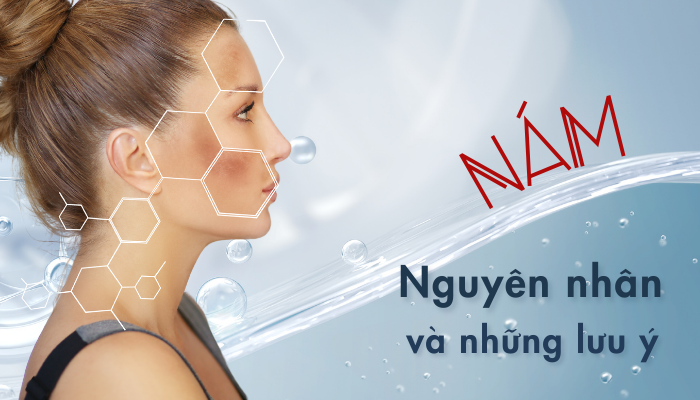 Nám da là gì? Nguyên nhân hình thành và những lưu ý cần biết