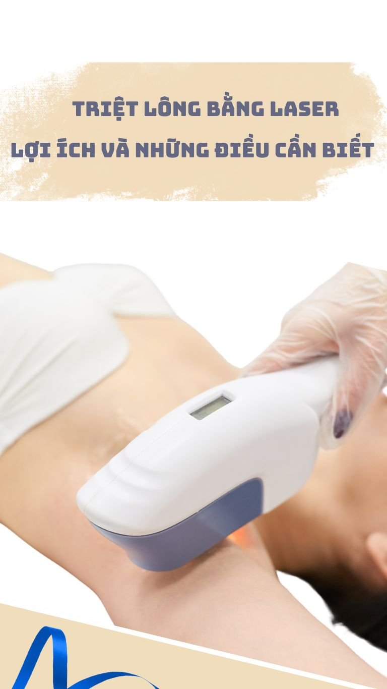TRIỆT LÔNG BẰNG LASER: LỢI ÍCH & NHỮNG ĐIỀU CẦN BIẾT
