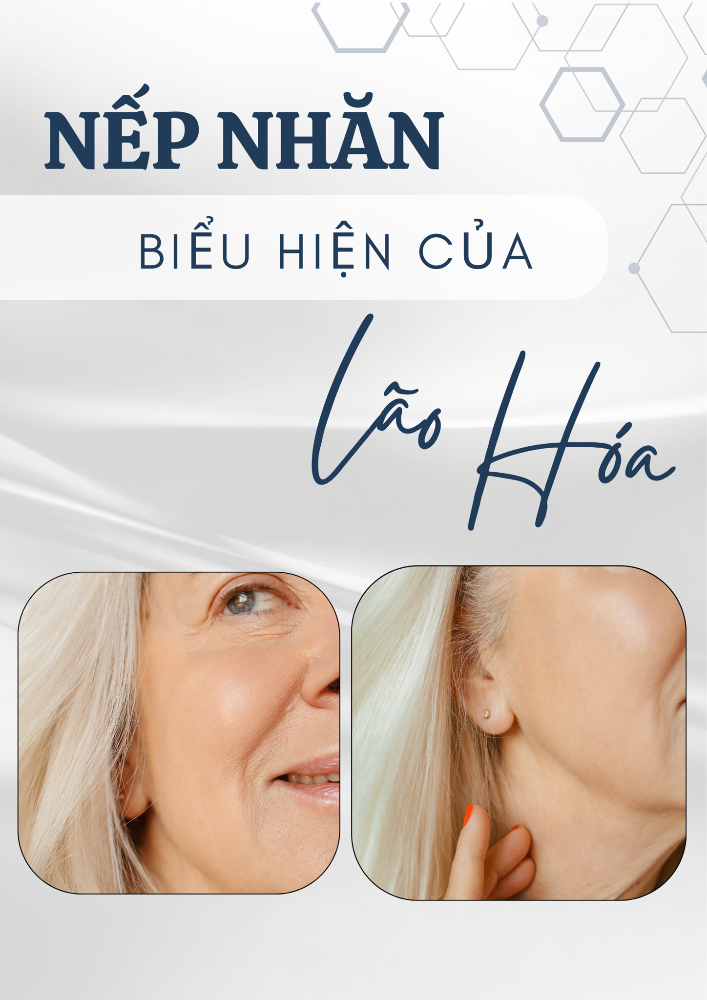 NẾP NHĂN - BIỂU HIỆN CỦA SỰ LÃO HOÁ