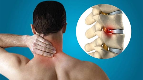 Đặc điểm của các đốt sống cổ