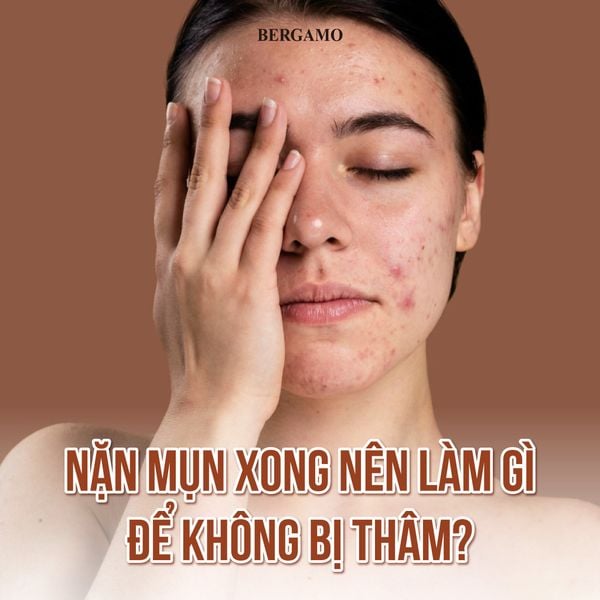 7. Khi Nào Nên Tìm Đến Bác Sĩ Da Liễu