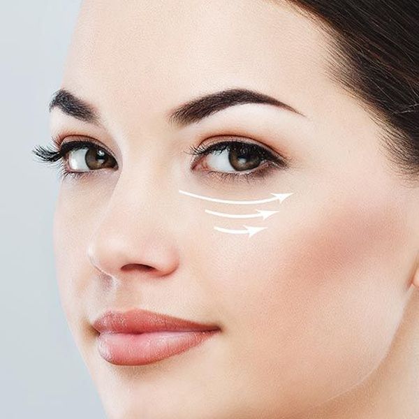 QUẦNG THÂM MẮT XUẤT HIỆN ĐẾN TỪ NHỮNG YẾU TỐ NÀO?