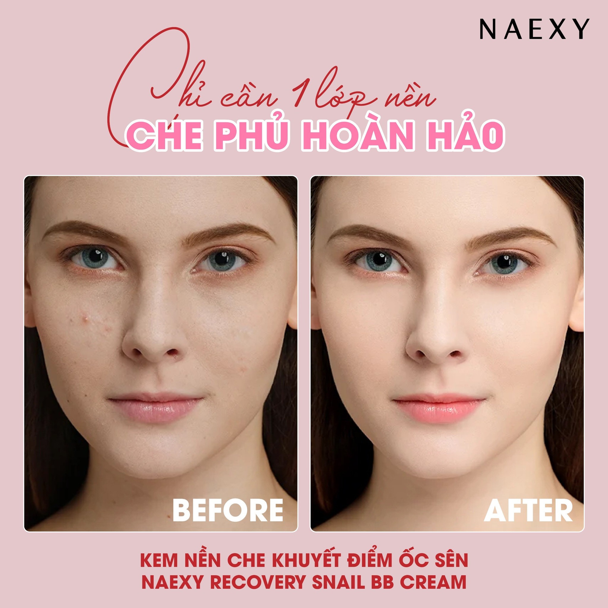 Ưu điểm