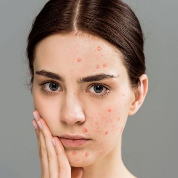 NHỮNG DẤU HIỆU NHẬN BIẾT DA MẶT BỊ MỎNG