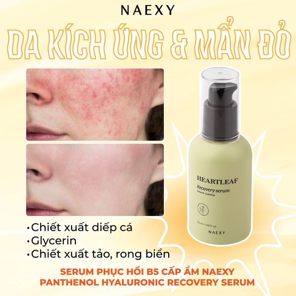 Da kích ứng và mẩn đỏ