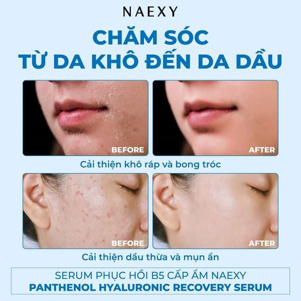 Ưu điểm