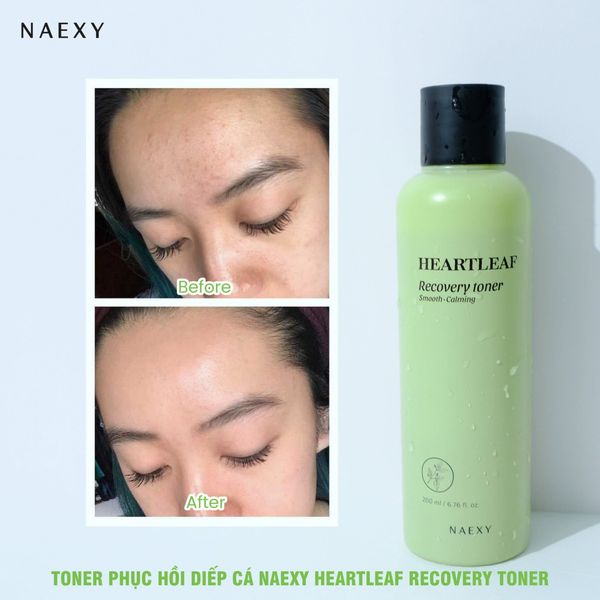 HƯỚNG DẪN SỬ DỤNG TONER PHỤC HỒI DIẾP CÁ NAEXY HEARTLEAF RECOVERY TONER