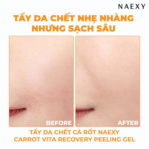Ưu điểm