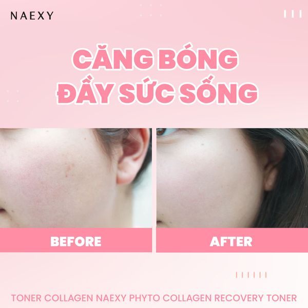 Căng bóng và đầy sức sống