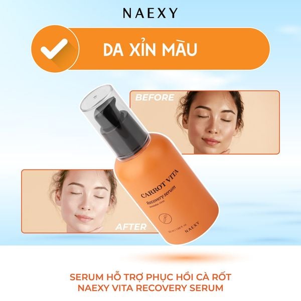 Da xỉn màu: Serum hỗ trợ phục hồi cà rốt Naexy Vita Recovery Serum 50ml