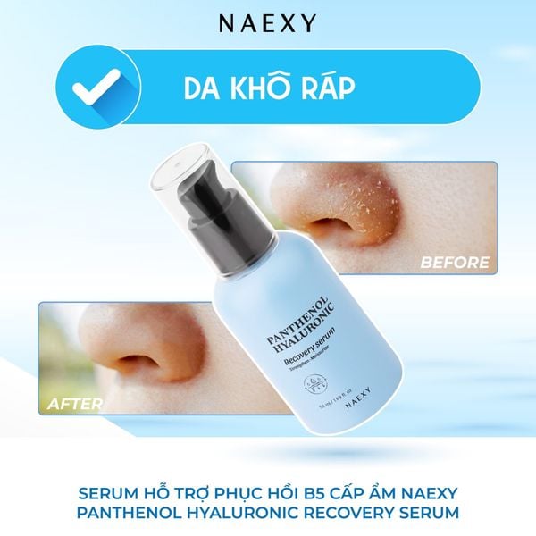 Da khô ráp: Serum hỗ trợ phục hồi B5 cấp ẩm Naexy Panthenol Hyaluronic Recovery Serum