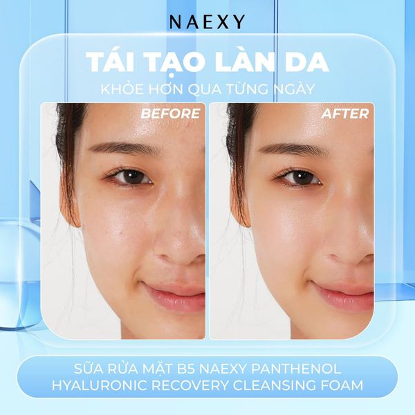 Tái tạo làn da khỏe hơn qua từng ngày