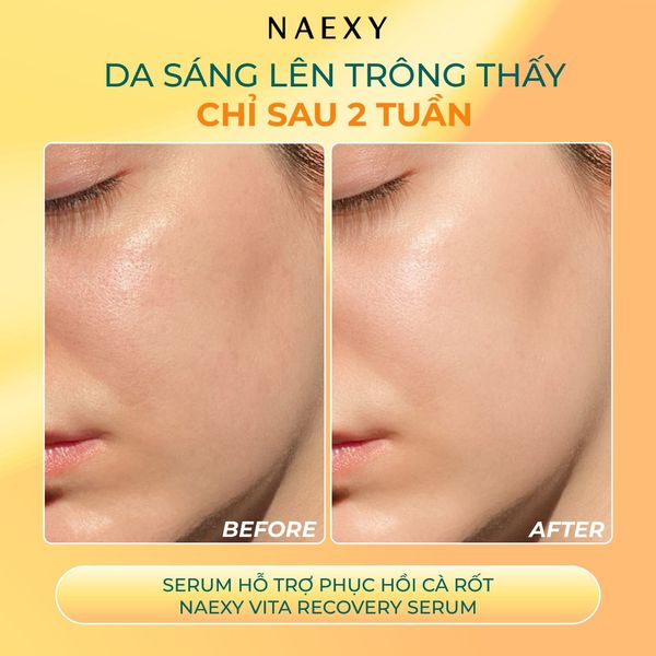 Da sáng lên trông thấy chỉ sau 2 tuần