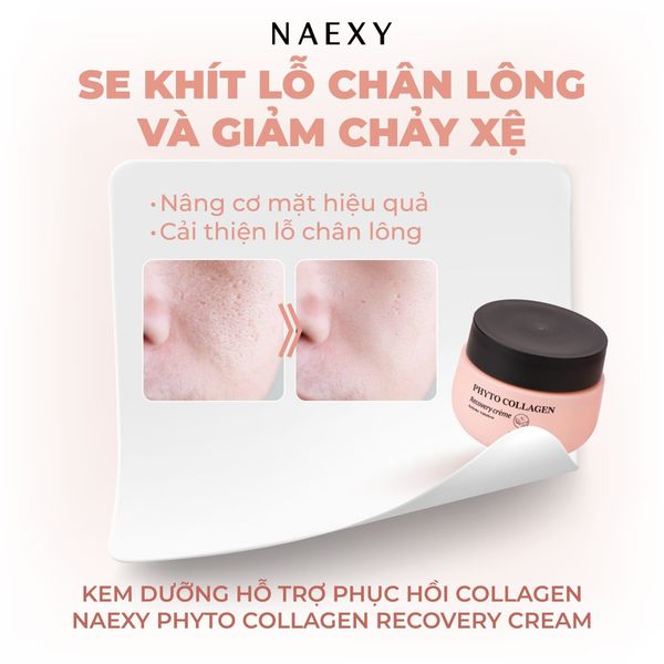 Ưu điểm