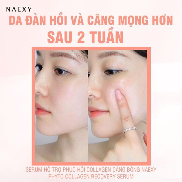 Ưu điểm