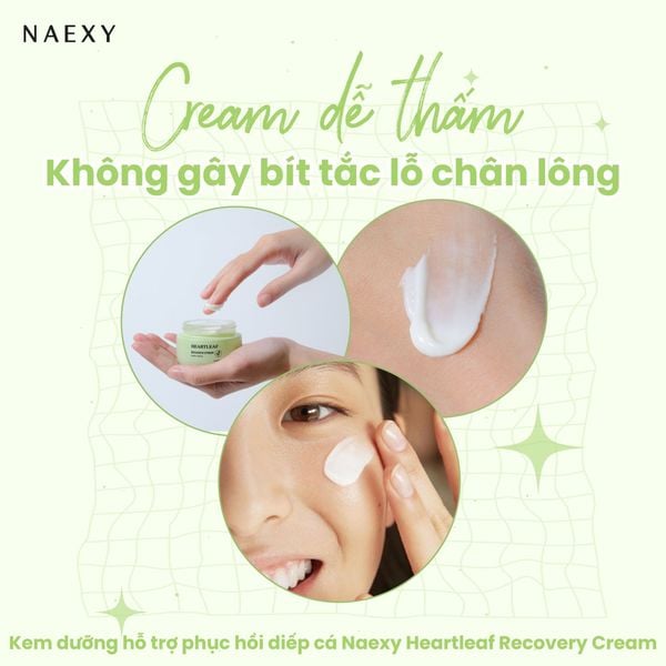 Ưu điểm