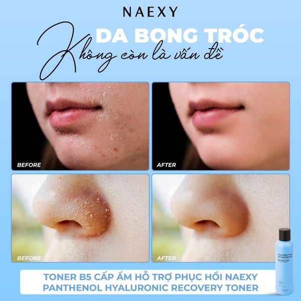 Da bong tróc không còn là vấn đề