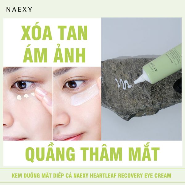 Xóa tan ám ảnh với quầng thâm mắt
