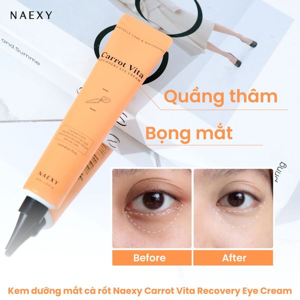 Cải thiện tình trạng quầng thâm ở vùng mắt