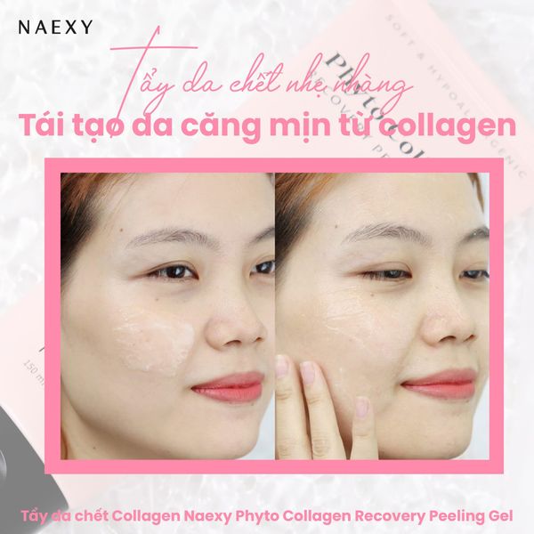 Tái tạo da căng mịn từ Collagen