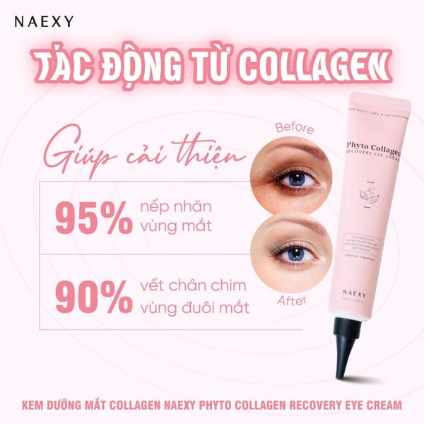 MÁCH BẠN KEM DƯỠNG MẮT GIẢM QUẦNG THÂM HIỆU QUẢ NHẤT HIỆN NAY 2