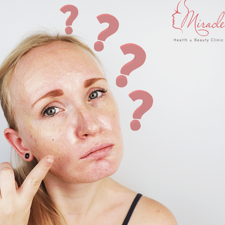 Da dầu và những quan niệm sai lầm khi chăm sóc: Sự thật bạn cần biết
