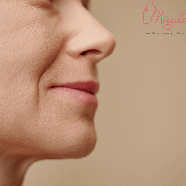 Nếp Nhăn Rãnh Mũi Môi – Vì Sao Khiến Bạn Già Hơn Và Cách Để Trẻ Trung Trở Lại?