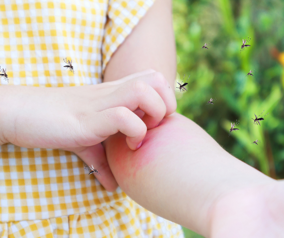 Sốt Xuất Huyết: Mối Nguy Hiểm Mùa Mưa Mà Cha, Mẹ Cần Biết