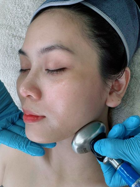 Chăm Sóc Da Lão Hóa: Giải Pháp Nâng Cơ Trẻ Hóa Da Công Nghệ Cao Từ Châu Âu Với Indiba