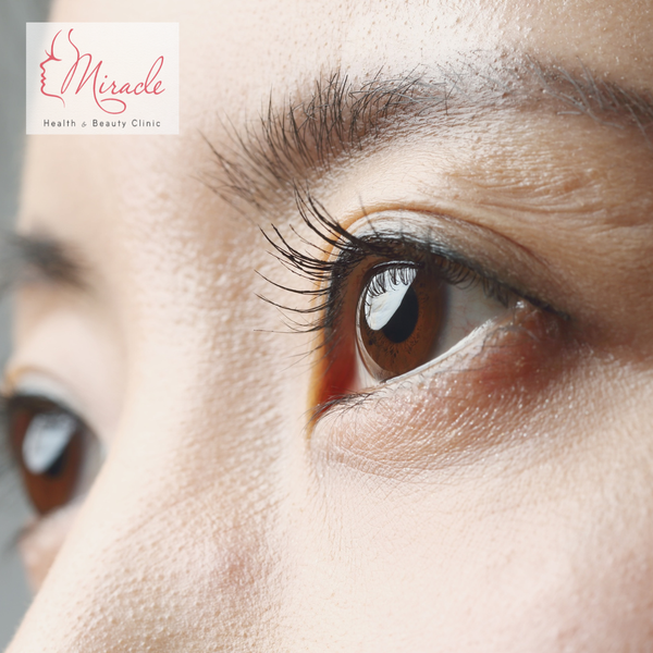 Lão Hóa Da Vùng Mắt: Bí Mật Từ Chuyên Gia & Giải Pháp Vàng