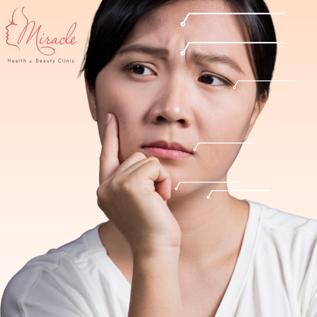 NHỮNG VỊ TRÍ TIÊM BOTOX HIỆU QUẢ?