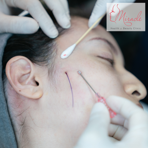 Căng Chỉ Da Mặt Có Đau Không?