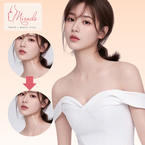 Gọt Hàm Bao Lâu Thì Lành?