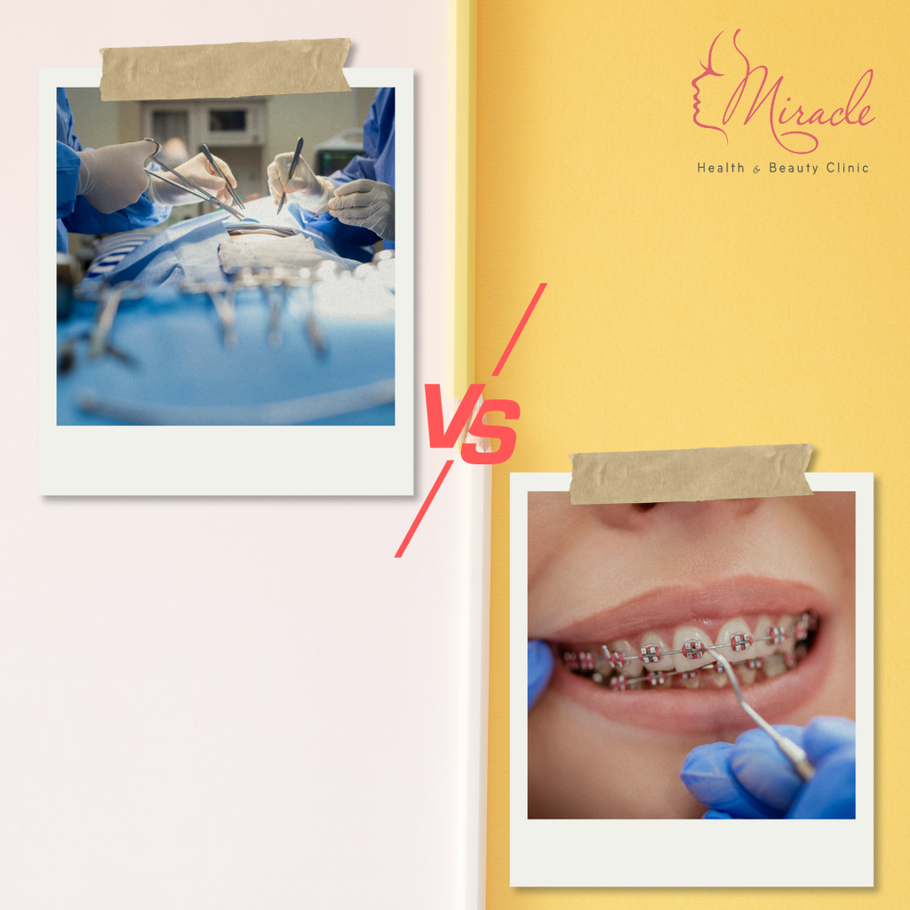 Nên Phẫu Thuật Hay Niềng Răng Hàm Hô?