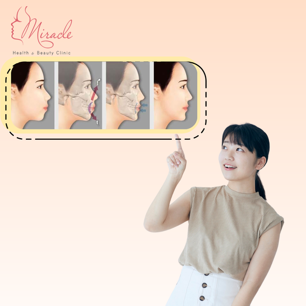 Phẫu Thuật Hàm Hô