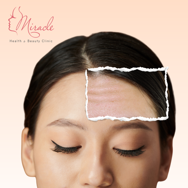 Phẫu thuật căng da trán có nguy hiểm không?