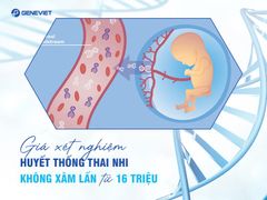 Chi phí xét nghiệm huyết thống thai nhi có đắt không?