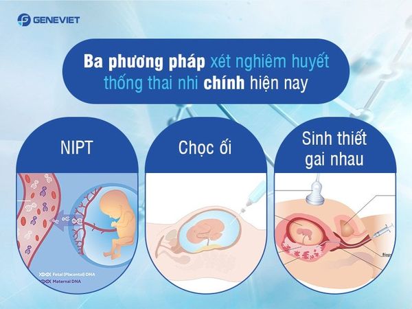 Độ chính xác của các phương pháp xét nghiệm huyết thống thai nhi
