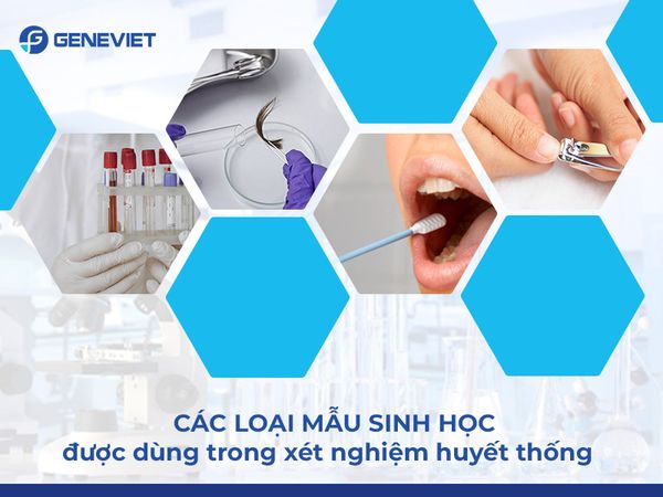 Không xét nghiệm máu có xác định được ADN huyết thống không?