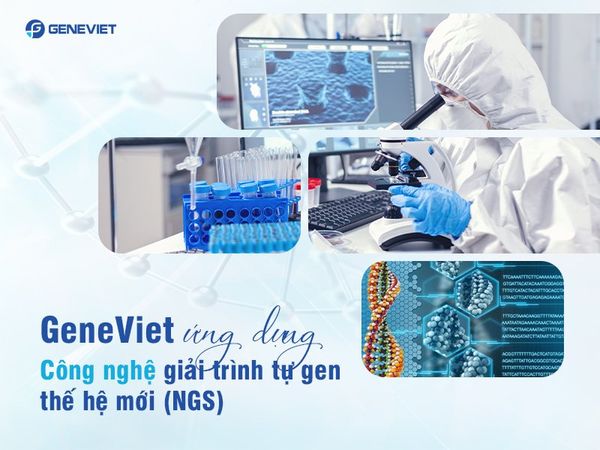 Sự khác biệt vượt trội của GeneViet trong công nghệ xét nghiệm ADN